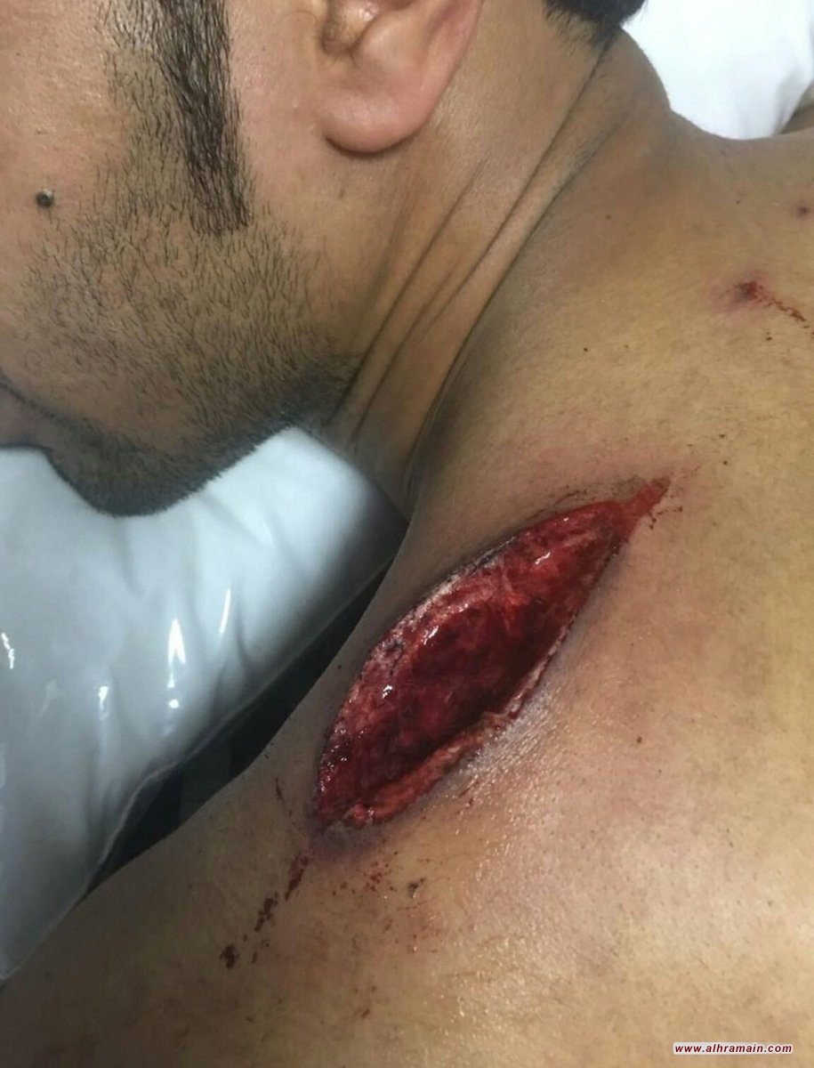 القوات السعودية تشن هجوماً متجددا على العوامية.. وإصابة العشرات وبينهم نساء وأطفال برصاص القناصة