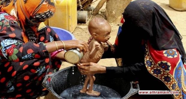 تقرير: طفل يمني يموت كل 10 دقائق بسبب الحصار السعودي